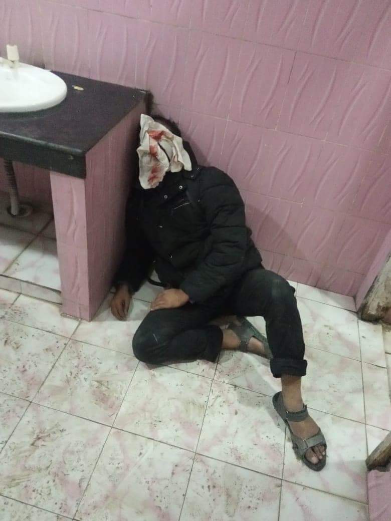 An injured student in the hostel of Jamia Milia Islamia