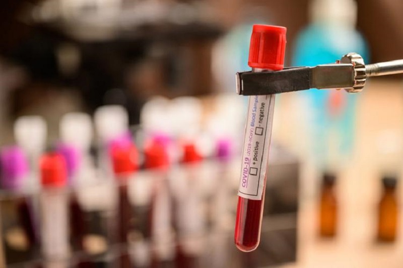Blood test tube