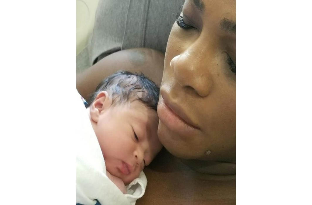 serena williams with her baby