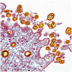 covid 19 microscope