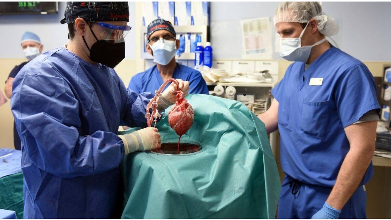 US surgeons successfully embed pig heart into a human body