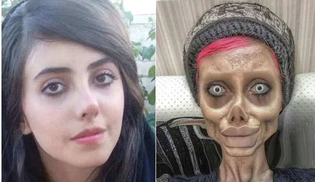 iran s woman ruins her body with plastic surgery to look like angelina jolie  releases her real photo