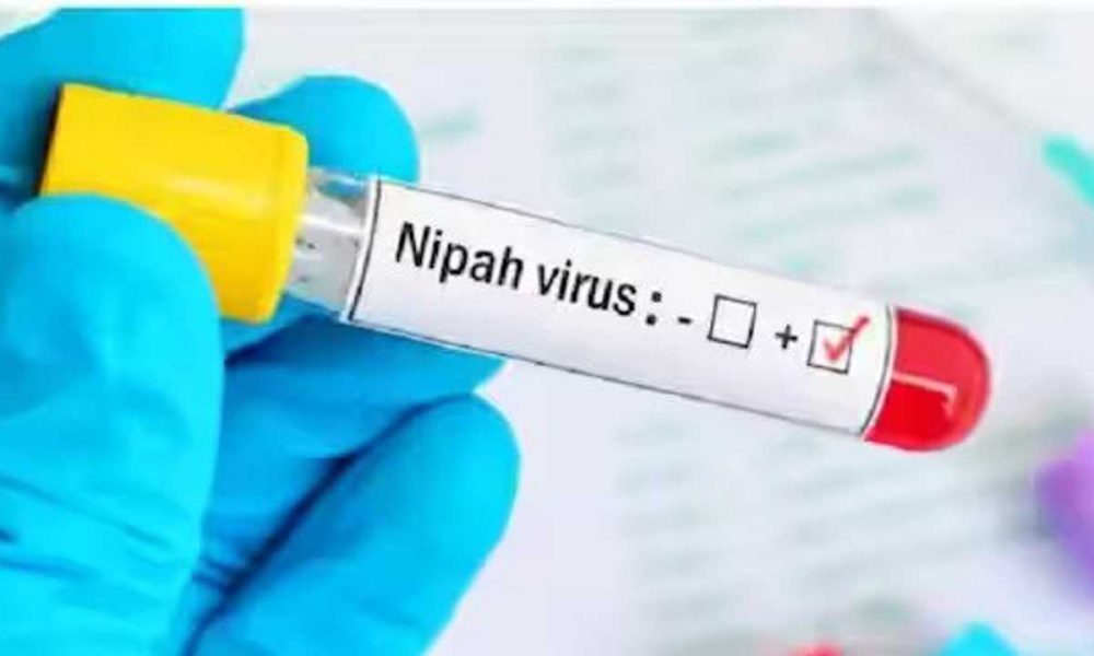 Nipah virus: