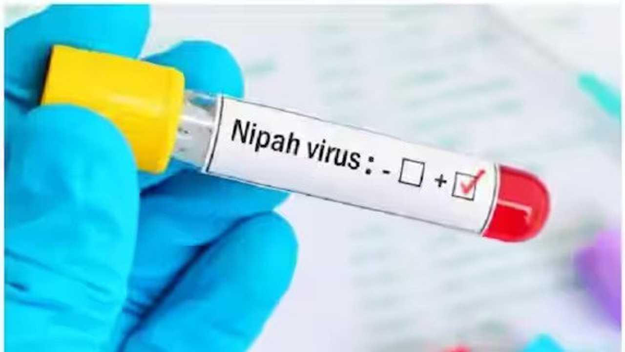 Nipah virus: