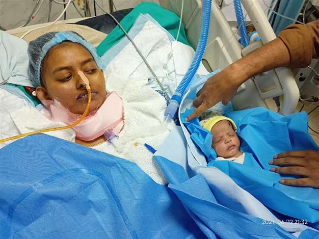 बीमार डॉक्टर की जान बचाने को डेढ़ करोड़ रुपये देगी योगी सरकार, कोविड मरीजों का इलाज करते खुद संक्रमित हुई थीं, डॉ शारदा सुमन 1 apn woman doctor lungs get damaged during covid duty